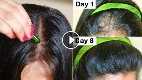 Vitamin E Oil For Double Hair Growth Turn Thin Hair To