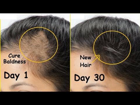 Flaxseed Gel for Hair: How to Make It at Home? | HealthNews