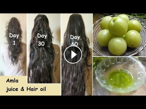 Dabur Amla Hair Oil  for Strong  Long and Thick Hair  275ml