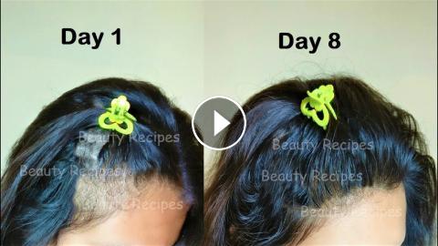 She rubs Aloevera on her Hair & turned Thin hair to Thick hair in 1 week -  Aloevera for Hair Growth