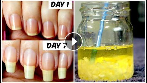 How To Grow Long Nails Faster In Just 7 Days (100% Working Treatment) By  Simple Beauty Secrets