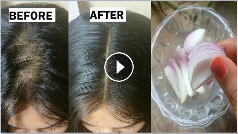 Onion & Coconut oil for Extreme HAIR GROWTH in 30 Days to get long hair,  thick hair naturally