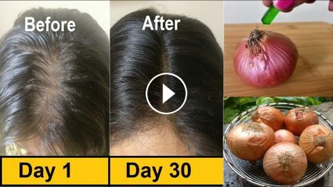 Use Vitamin E Oil for Hair Growth mixed with Onion juice for Long Hair,  Regrow lost hair from roots