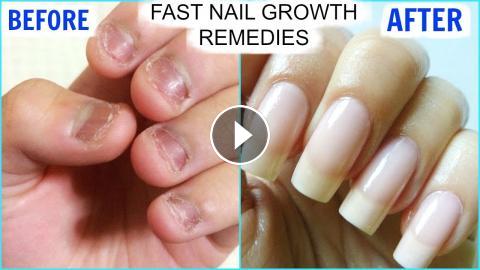 How To GROW Long Strong Nails Fast At Home | SuperPrincessjo
